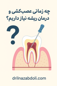 چه زمانی به عصب کشی نیاز داریم؟